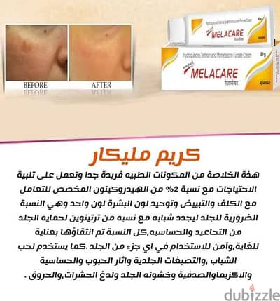 كريم مليكار cream malecare