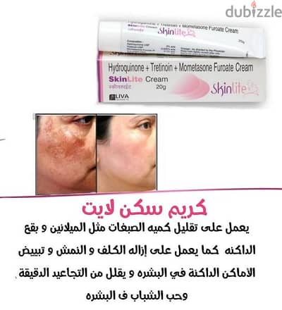 كريم سكين لايت cream skin lite