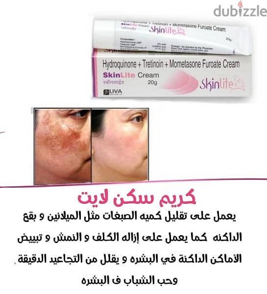 كريم سكين لايت cream skin lite 0