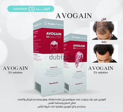 Avogen hair loss solution