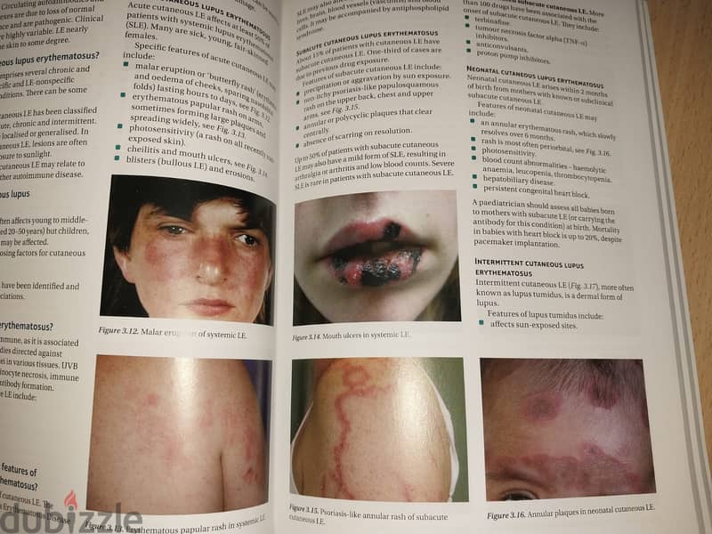 Medical Book (Dermatology Made easy) ( Brand new) 1