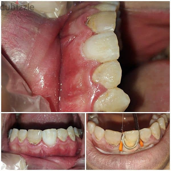 طبيب أسنان عام جاهز فيفا General dentist pass viva 3