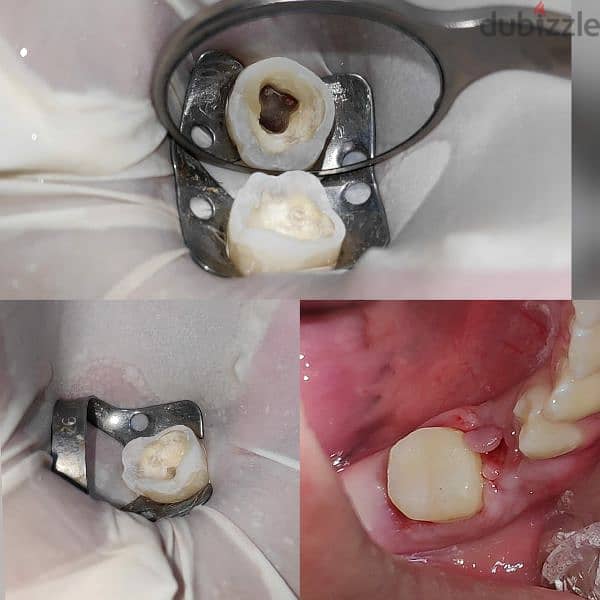 طبيب أسنان عام جاهز فيفا General dentist pass viva 5