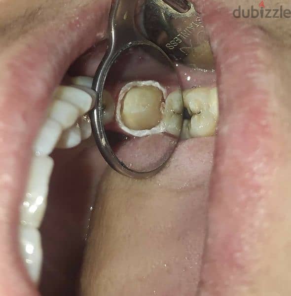 طبيب أسنان عام جاهز فيفا General dentist pass viva 7