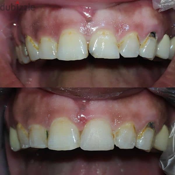 طبيب أسنان عام جاهز فيفا General dentist pass viva 9
