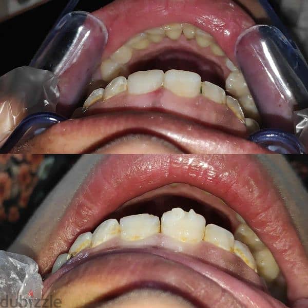 طبيب أسنان عام جاهز فيفا General dentist pass viva 10