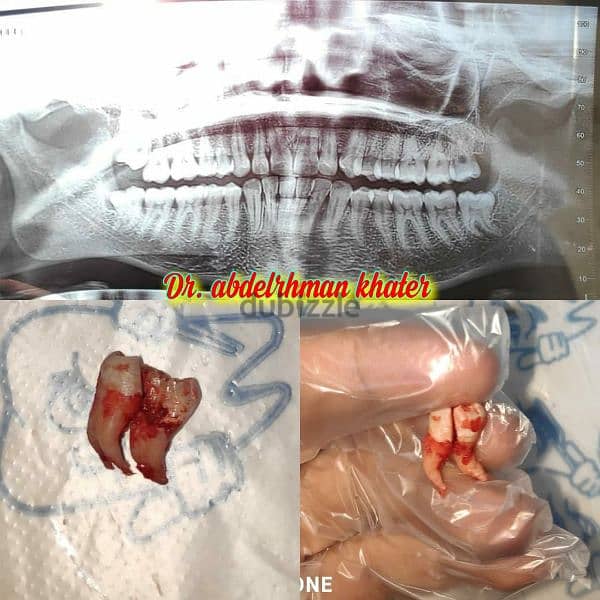 طبيب أسنان عام جاهز فيفا General dentist pass viva 14
