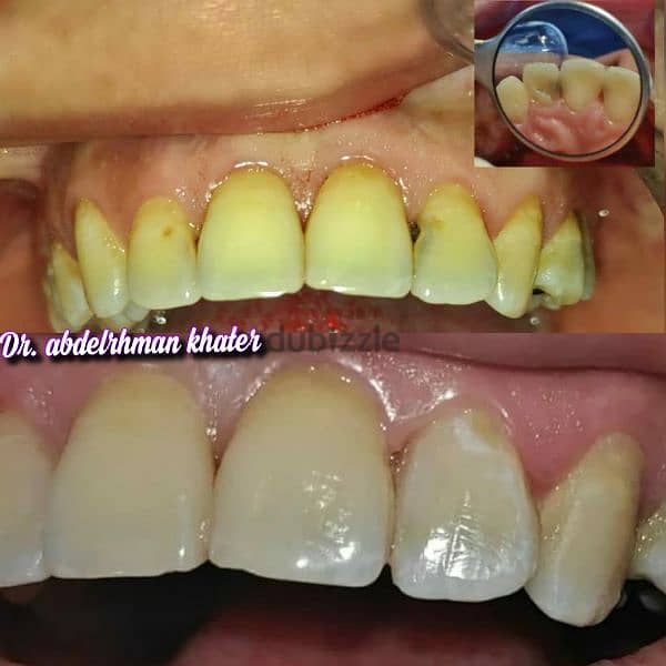 طبيب أسنان عام جاهز فيفا General dentist pass viva 15