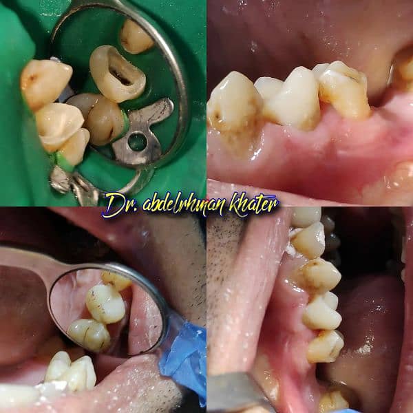 طبيب أسنان عام جاهز فيفا General dentist pass viva 16