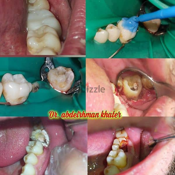 طبيب أسنان عام جاهز فيفا General dentist pass viva 17