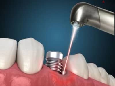 Wanted Indian Orthodontist at Nizwa for a Reputed Centre