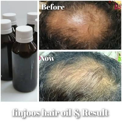 EXTRA VIRGIN COCONUT OIL FOR HAIR GROWTH