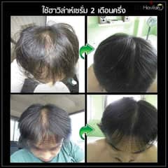 Hair Tonic Transplant Originally from Thailand