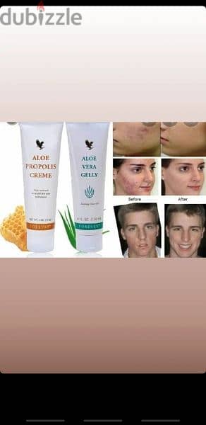 forever  aloevera gelly 15