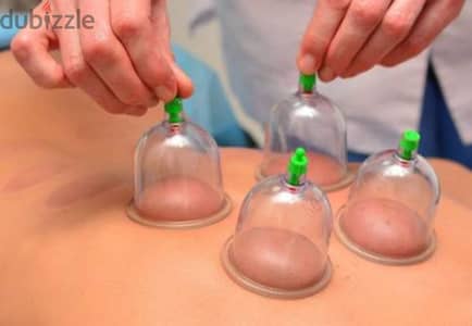 الحجامة  Cupping Therapy