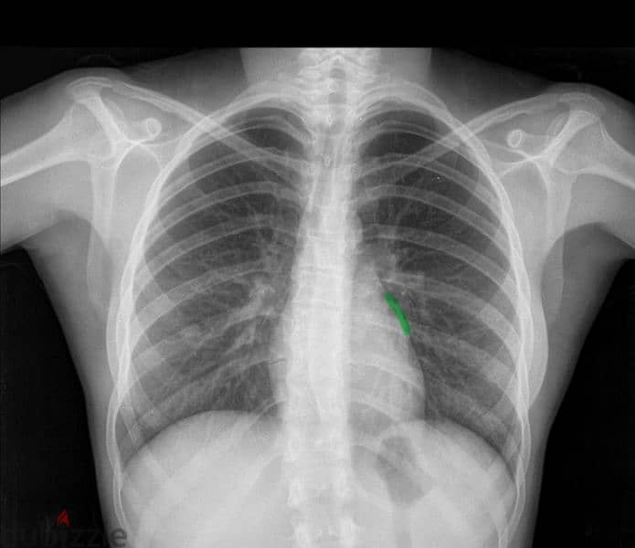 فني اشعه. . Xray Technician 0