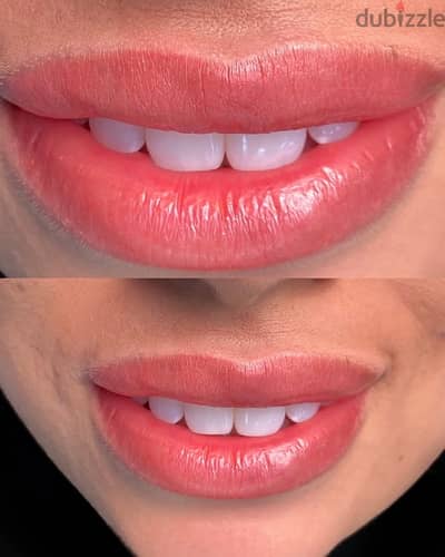 احتاج موديل توريد شفايف مجاني micro pigmentation lips free