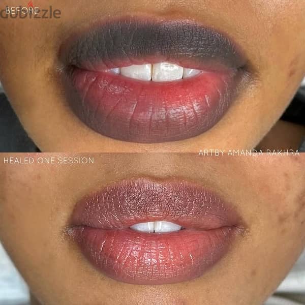 احتاج موديل توريد شفايف مجاني micro pigmentation lips free 1