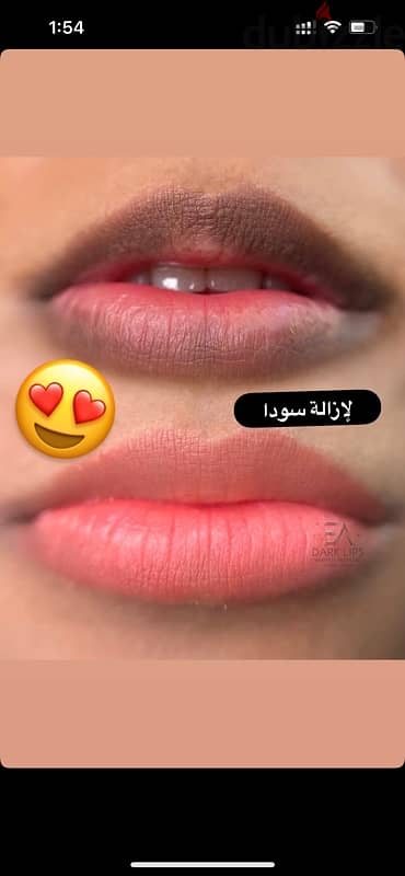 احتاج موديل توريد شفايف مجاني micro pigmentation lips free 3