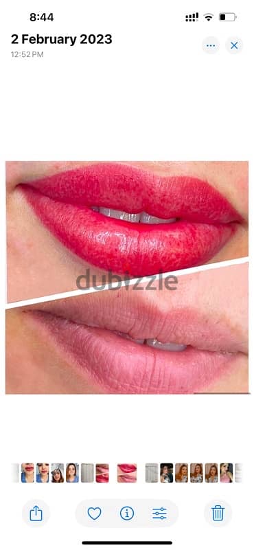 احتاج موديل توريد شفايف مجاني micro pigmentation lips free 4