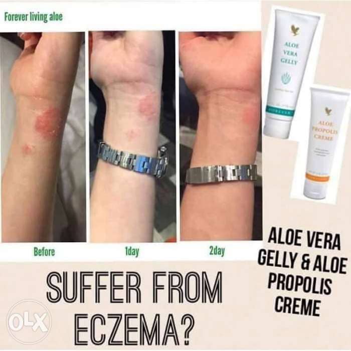 Eczema,Acne skin issues 2