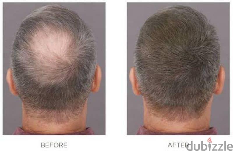 cover for thin hair 1