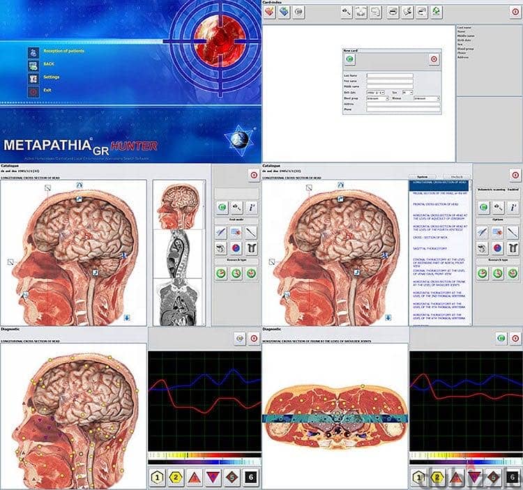 جهاز التردد  الحيوي  Life Reasonance Intelligence System NLS Plus 9