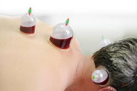 Professional Hijama & Natural Herbal Therapy Services